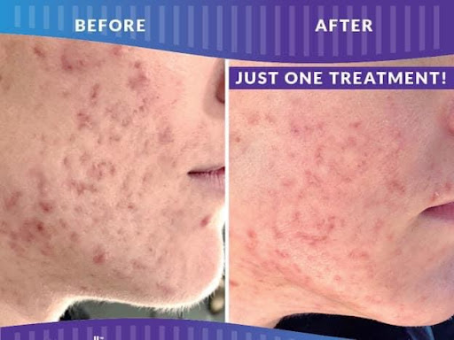 Explore sick tattoo ideas for guys, creative tattoo ideas in Savannah, available at Haute Brows. Cosmetic Tattoo