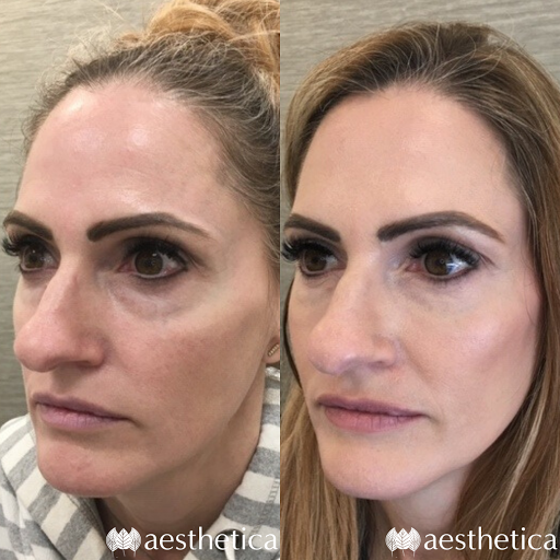 Explore simple elephant tattoo ideas, creative tattoo ideas in Pleasant Grove, available at Aesthetica