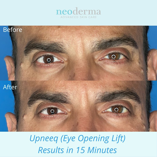 Explore dog collar tattoo ideas, creative tattoo ideas in Anaheim, available at Neoderma