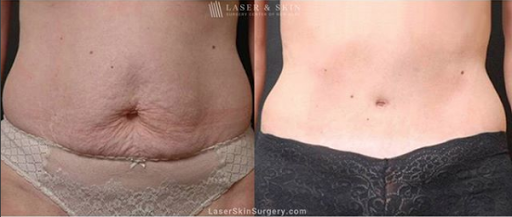 Explore girly tattoo ideas, creative tattoo ideas in Southampton, available at Laser & Skin Surgery Center of New York - Southampton