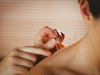 Denver Acupuncture Medicine - Photo 5 - Car repair in Denver, CO, Denver