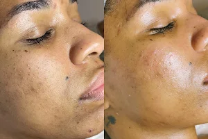 Epidedmy Skin Care Philadelphia image