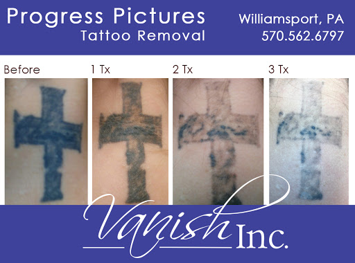 Explore deltoid tattoo ideas, creative tattoo ideas in Williamsport, available at Vanish Laser & Skin, Inc.