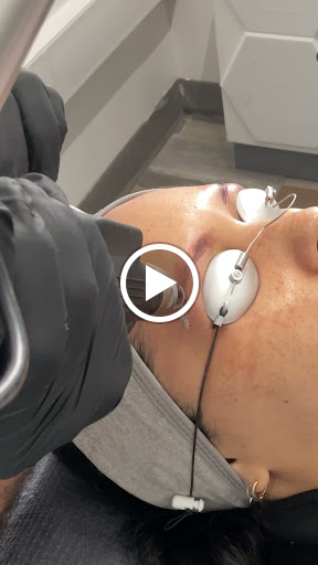 Explore juice wrld tattoo ideas, creative tattoo ideas in New York, available at Ag2g Laser Tattoo Removal & MedSpa