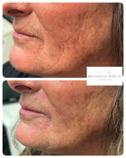 Explore no fear tattoo ideas, creative tattoo ideas in Brunswick, available at Brunswick Medical Aesthetics