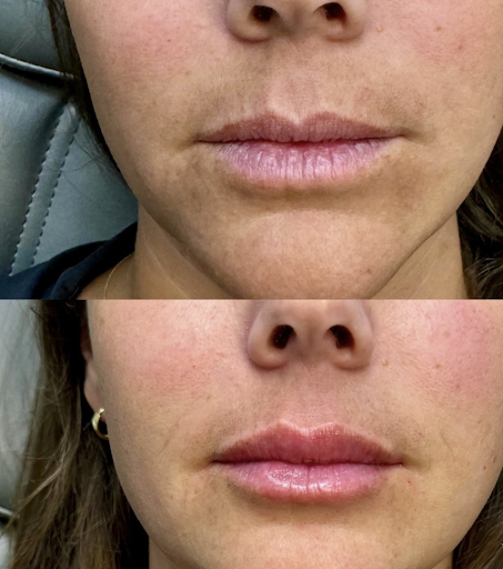 Find paradox tattoo ideas for your next unique tattoo in Powell at A Younger You Aesthetics