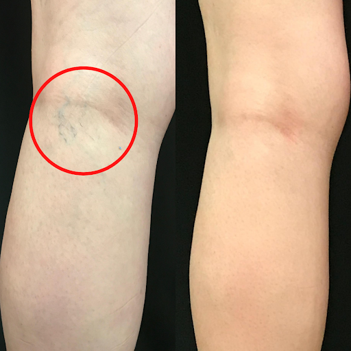 Explore music tattoo sleeve ideas, creative tattoo ideas in Brookfield, available at Milwaukee Laser & Body Aesthetics