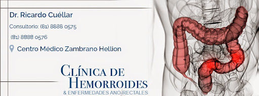 Clinica de Hemorroides en Monterrey