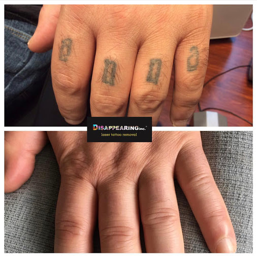 Explore forearm half sleeve tattoo ideas, creative tattoo ideas in Lawrence, available at Removery Tattoo Removal & Fading