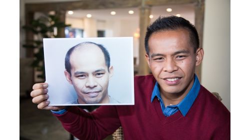 Hair Transplantation Clinic «Bosley Medical - Long Island», reviews and photos, 324 S Service Rd Suite 122, Melville, NY 11747, USA