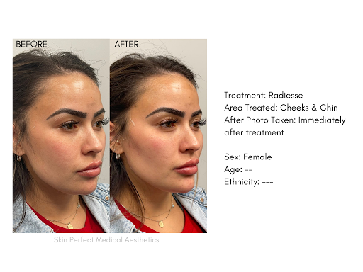 Skin Perfect Medical Aesthetics - Rancho Cucamonga image