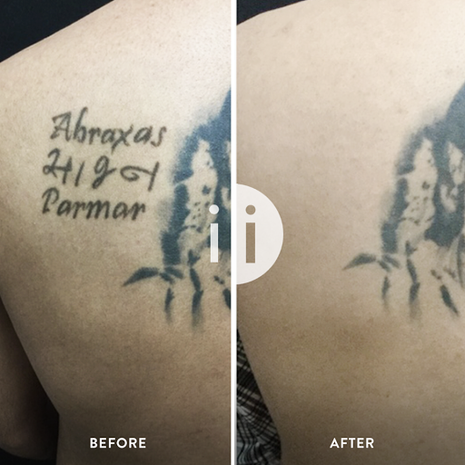 Explore crash bandicoot tattoo ideas, creative tattoo ideas in Henrico, available at Removery Tattoo Removal & Fading