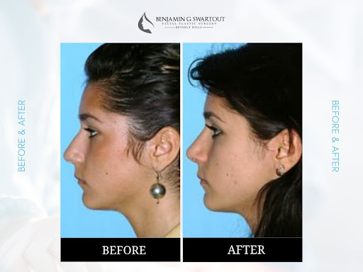 Benjamin G. Swartout, Facial Plastic Surgery image