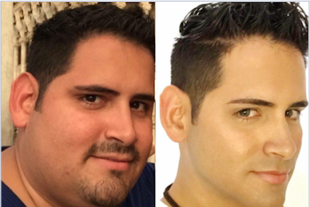 ALO Bariatrics Guadalajara - ALO Bariatrics Guadalajara