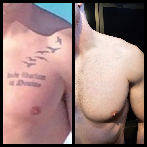 Explore clock tattoos ideas, creative tattoo ideas in Dubuque, available at Retrospect Tattoo Removal