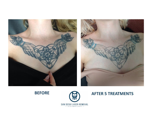 Explore 1 2 sleeve tattoo ideas, creative tattoo ideas in San Diego, available at Removery Tattoo Removal & Fading