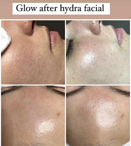 Medical Spa «Lavender Med Spa», reviews and photos, 3675 Crestwood Pkwy #400, Duluth, GA 30096, USA