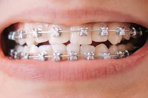 Ideal Dental Clinic. (Dr.Aman Chauhan ) orthodontist treatments implant super specialty smile design BEST DOCTOR in etah image