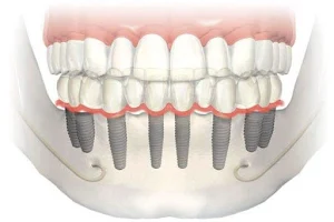 SMILE DENTAL CARE & IMPLANT CENTER (Dental Clinic) image