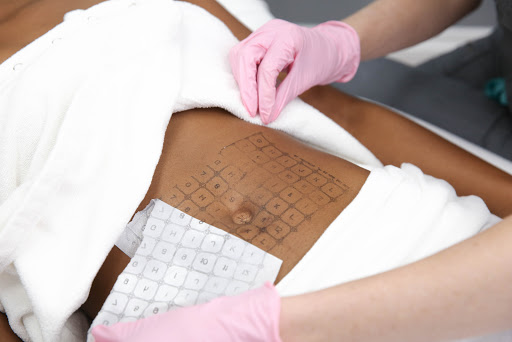 Explore healthcare tattoo ideas, creative tattoo ideas in Meridian, available at LaserAway