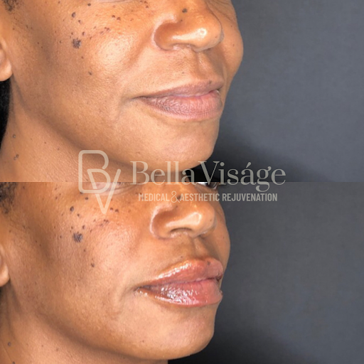 Explore floral tattoo cover up ideas, creative tattoo ideas in Lakeland, available at Bella Visge Medical & Aesthetic Rejuvenation