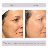 Dermacare Med Spa in Carlsbad - Photo 7 - Car repair in Carlsbad, CA, Carlsbad