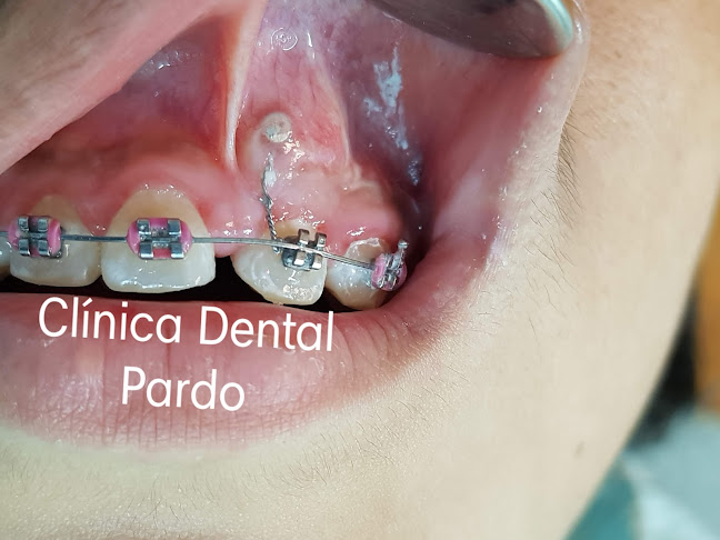 CLÍNICA DENTAL PARDO EIRL - Chimbote
