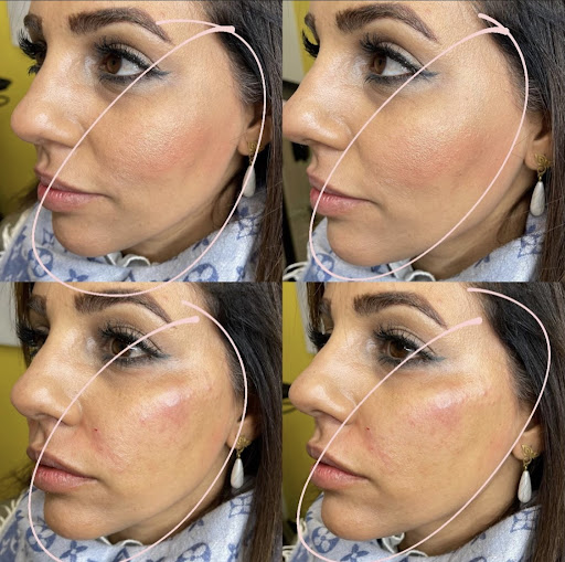 Lifted Beauty Medical Practice image