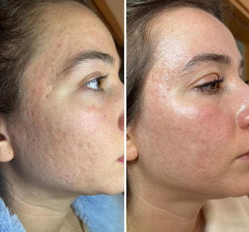 Explore calf tattoo ideas, creative tattoo ideas in Princeton Junction, available at Princeton Aesthetics