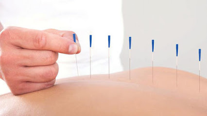 Akupunktur Tedavisi Dr. Kanat Tayfun