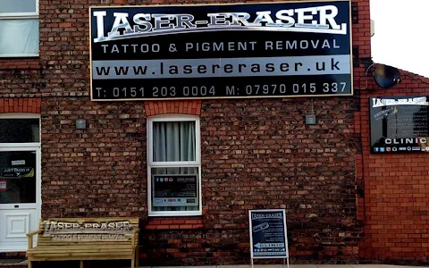 Laser Eraser Tattoo and Pigment Removal Services image
