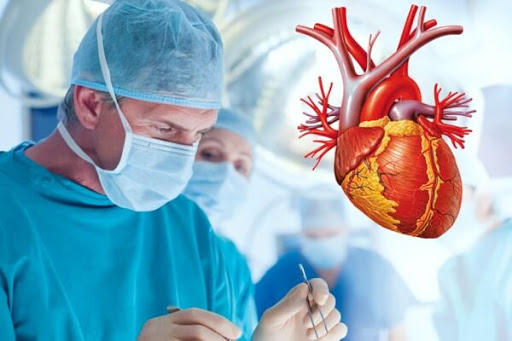 Cirugia Cardiovascular Panamá