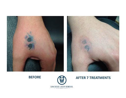 Explore simple tattoo outline ideas, creative tattoo ideas in San Diego, available at Removery Tattoo Removal & Fading