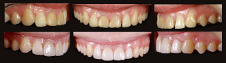 Dentiste Dr Deage Frédéric - Dentiste Implantologie Haute Loire 43 43400 Le Chambon-sur-Lignon