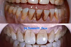 32 Diamonds Dental Clinic - Best Dentist in Vaishali image