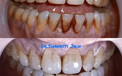 32 Diamonds Dental Clinic - Best Dentist in Vaishali image
