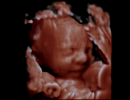 Ultrasound Dimensions - Ultrasound Dimensions