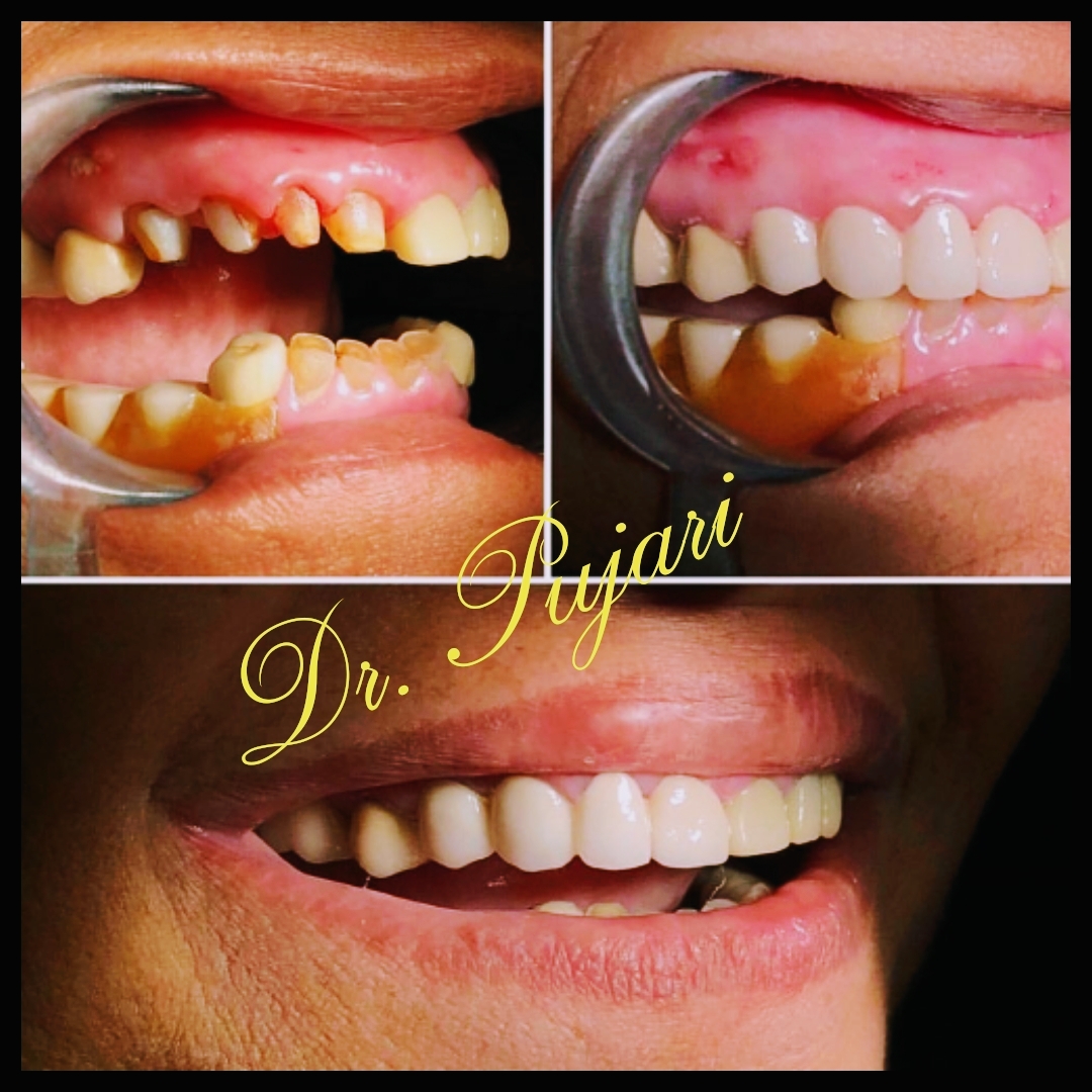 I SMILE DENTAL CARE - Channasandra (Multispecialty Dental Clinic, Root Canal, Orthodontic, Invisalign & Implant Centre)