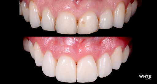 White Clinic - Dentist | Clínica Dentária & Biological Dentistry