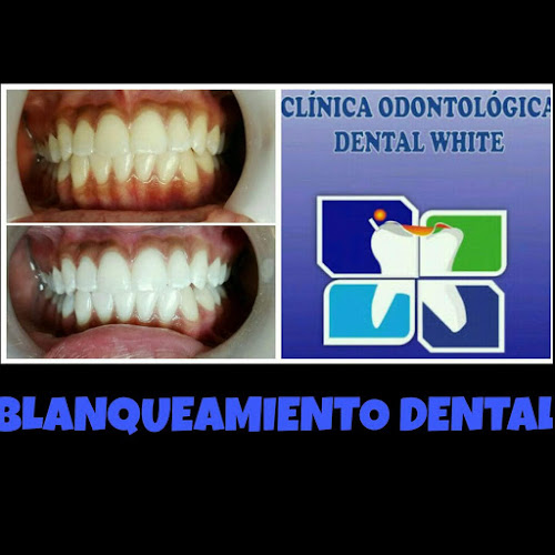 Opinii despre CLINICA ODONTOLOGICA DENTAL WHITE în Cali - Dentista
