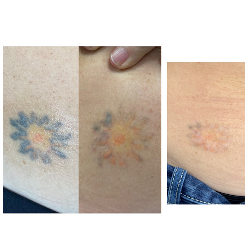 Explore korean tattoo ideas for guys, creative tattoo ideas in Marietta, available at Sink or Swim Aesthetics