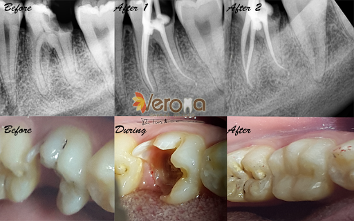 Verona Dental Clinic - عيادة فيرونا لطب الاسنان