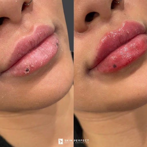 Explore fairy garden tattoo ideas, creative tattoo ideas in Whittier, available at Skin Perfect Medical Aesthetics