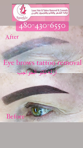 Explore marathon running tattoo ideas, creative tattoo ideas in Tempe, available at Sparkle Laser HairTattoo Removal