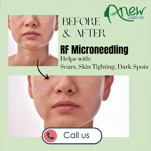 Explore design mac miller tattoo ideas, creative tattoo ideas in El Monte, available at Anew Laser MD