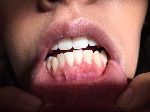 Scottsdale Dental Implants & Periodontics - Roya Zojaji, DDS, MS