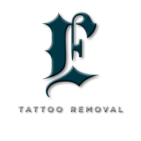 Explore butterfly spine tattoo ideas, creative tattoo ideas in San Diego, available at Evolve Tattoo Removal
