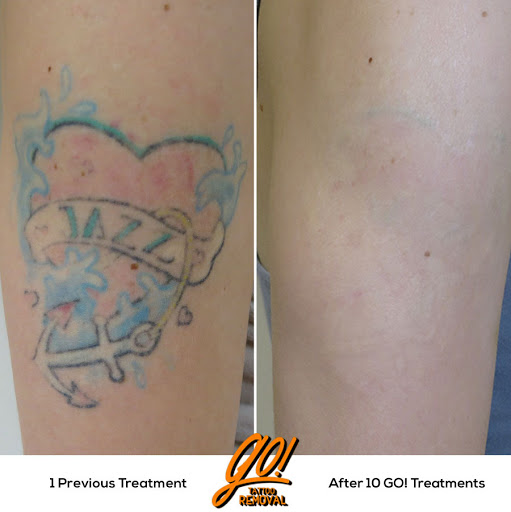 Explore leg flower tattoo ideas, creative tattoo ideas in Allentown, available at Removery Tattoo Removal & Fading