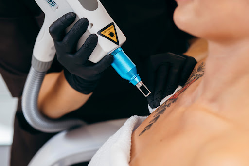 Explore filler tattoo ideas for guys, creative tattoo ideas in Littleton, available at LaserAll