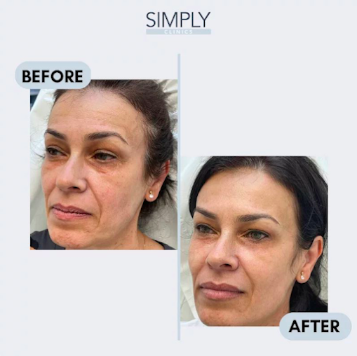Simply Clinics - Chelsea - Simply Clinics - Chelsea